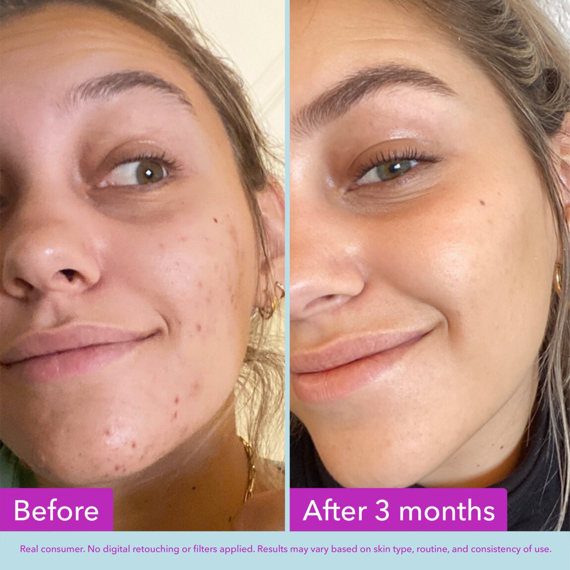 niacinamide-brightening-toner-a0 zb_p.jpg
