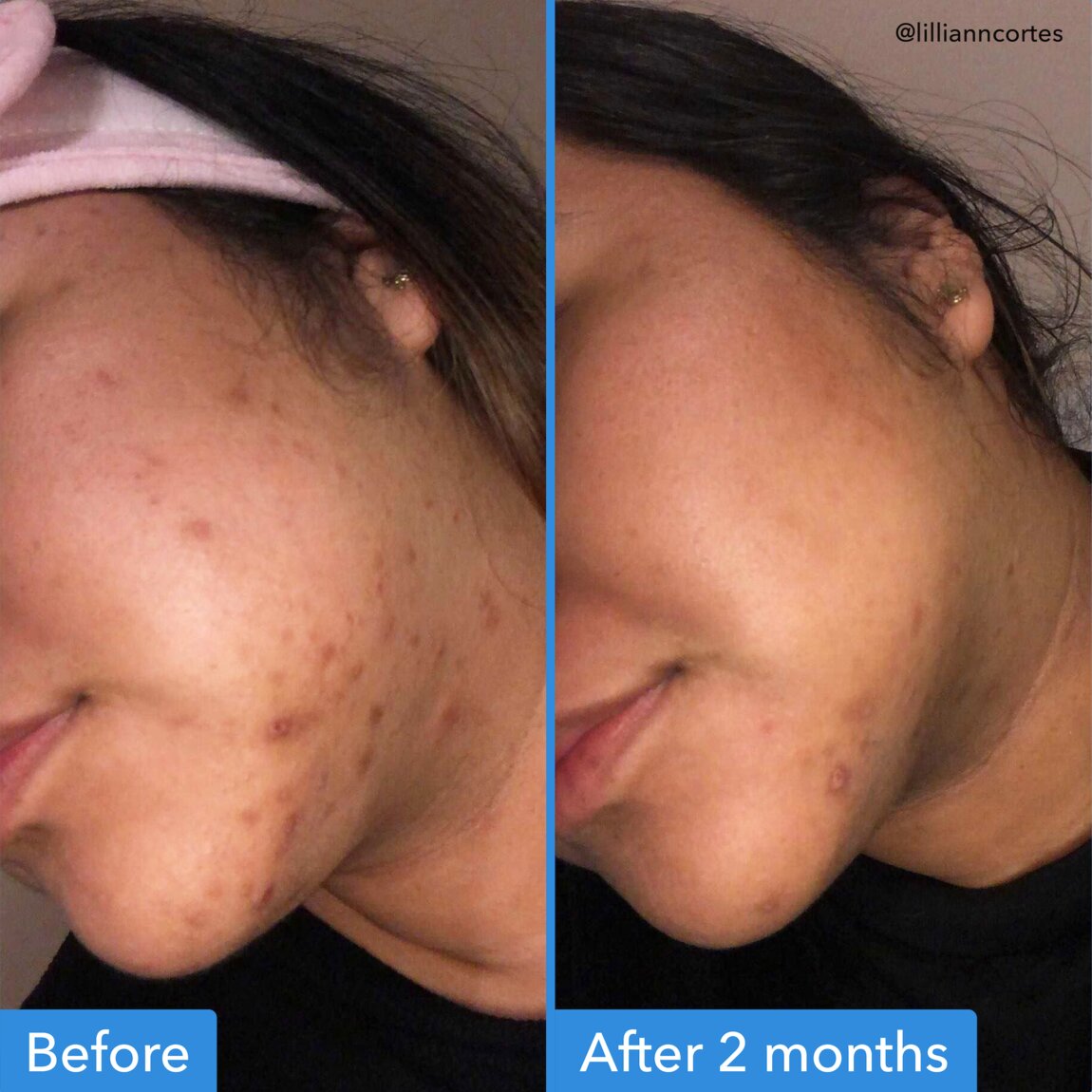 discoloration-correcting-serum-s1 zb_p.jpg